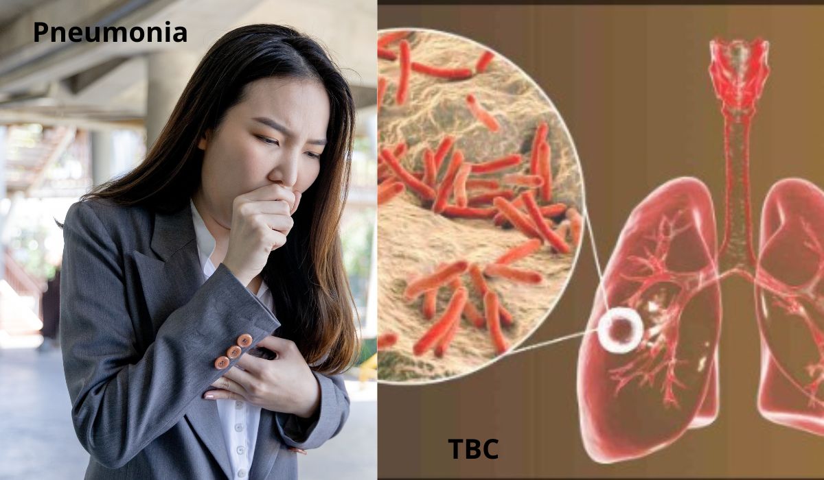 Lebih Berbahaya Mana, Pneumonia atau TBC ?