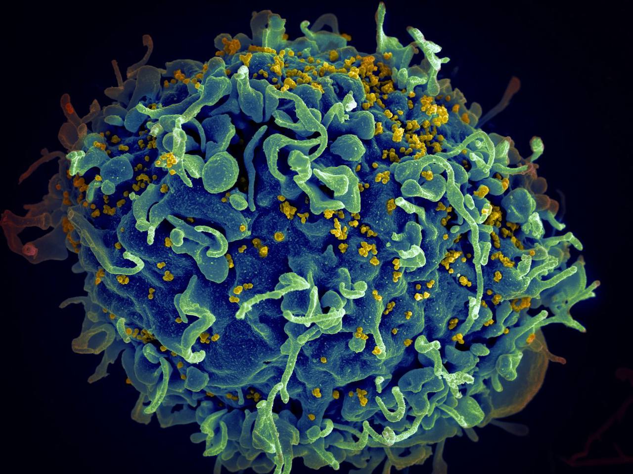 Ilmuwan Temukan Cara Hilangkan HIV di Sel Tubuh Tanpa Menggunakan Obat 