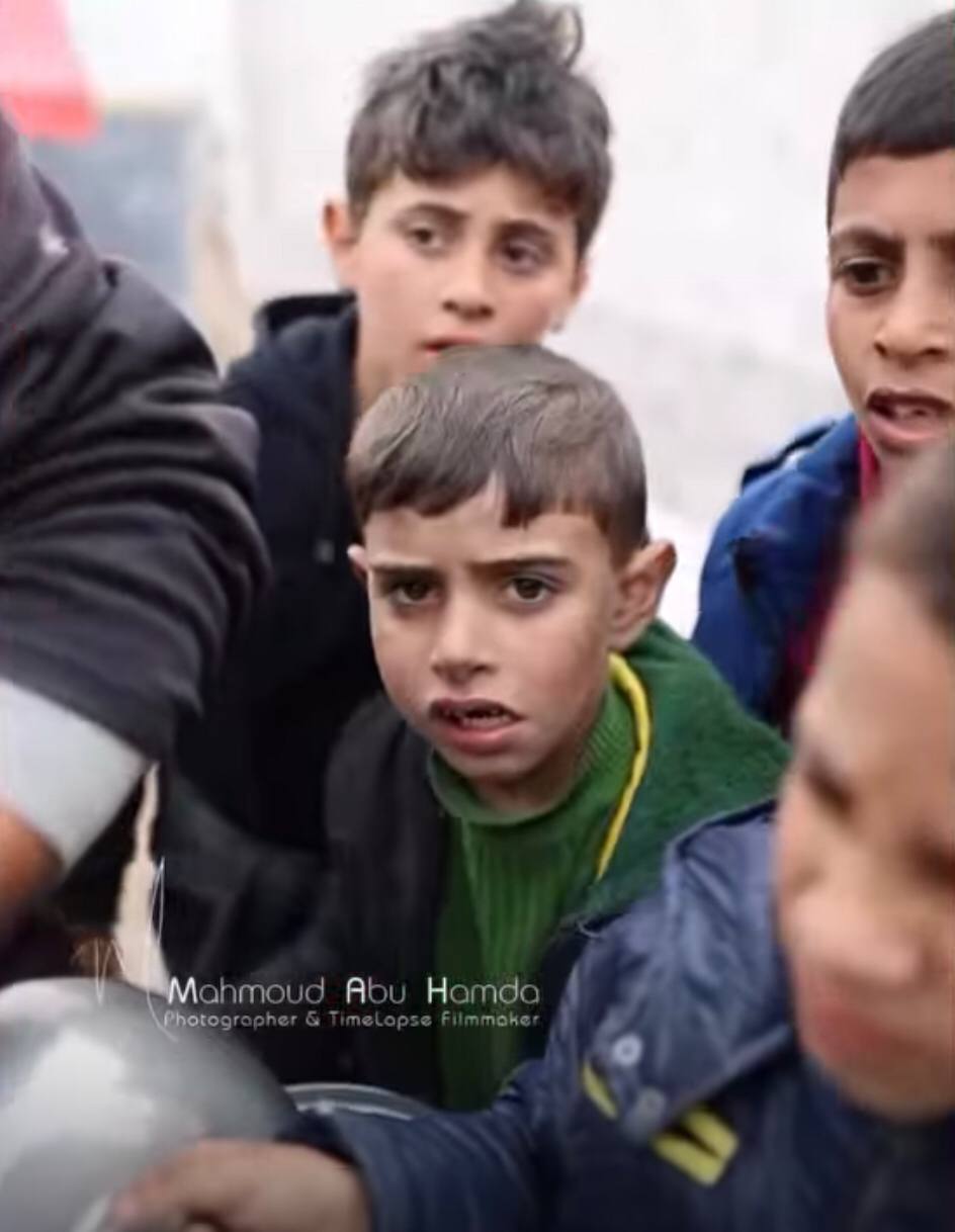 PBB: Anak-Anak di Gaza Alami Malnutrisi dan Kelaparan, Terburuk di Dunia