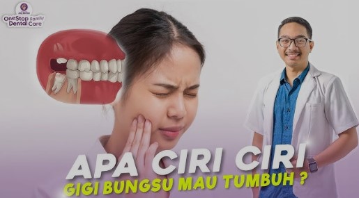 Apa Itu Gigi Bungsu dan Mengapa Disebut Gigi Bungsu? Cari Tahu Sendiri Ya!