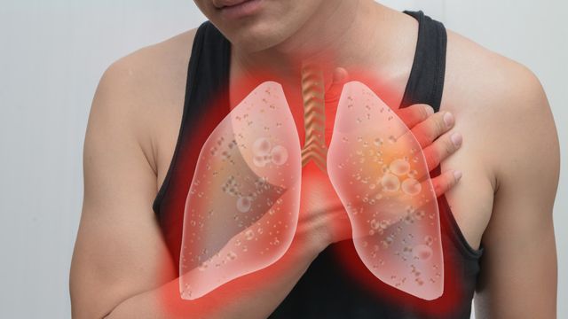 Wajib Tahu, Ini Bedanya Pneumonia dan TBC 