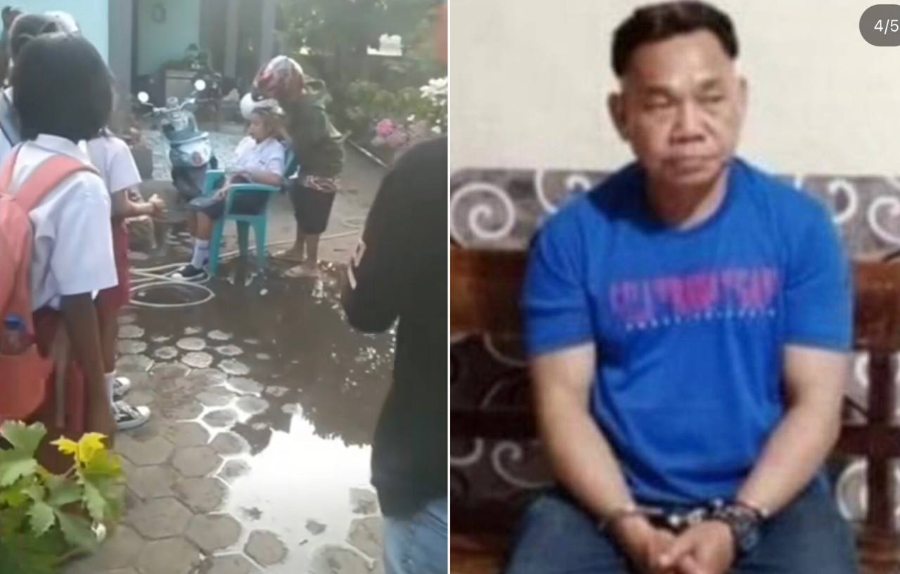 Sadis! Sakit Hati Cinta Ditolak, Pria 49 Tahun Siram Air Keras ke Wajah Siswi SMP