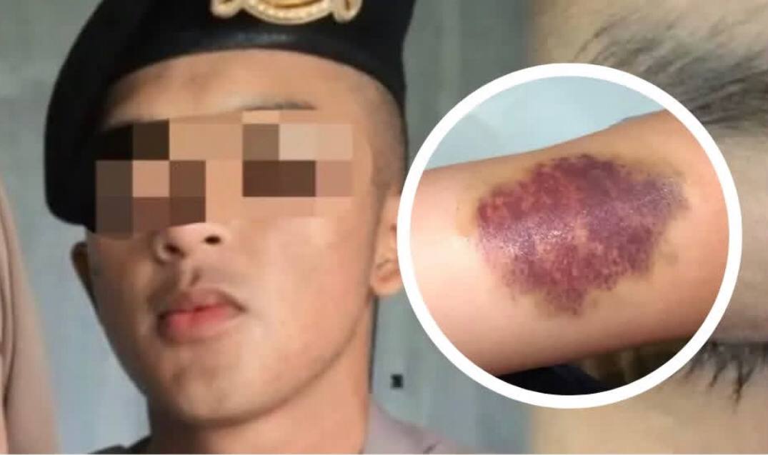 Viral, Seorang Oknum Polda Jabar Aniaya Kekasih hingga Lebam dan Trauma, Gegara Kepergok Notif DM Instagram 