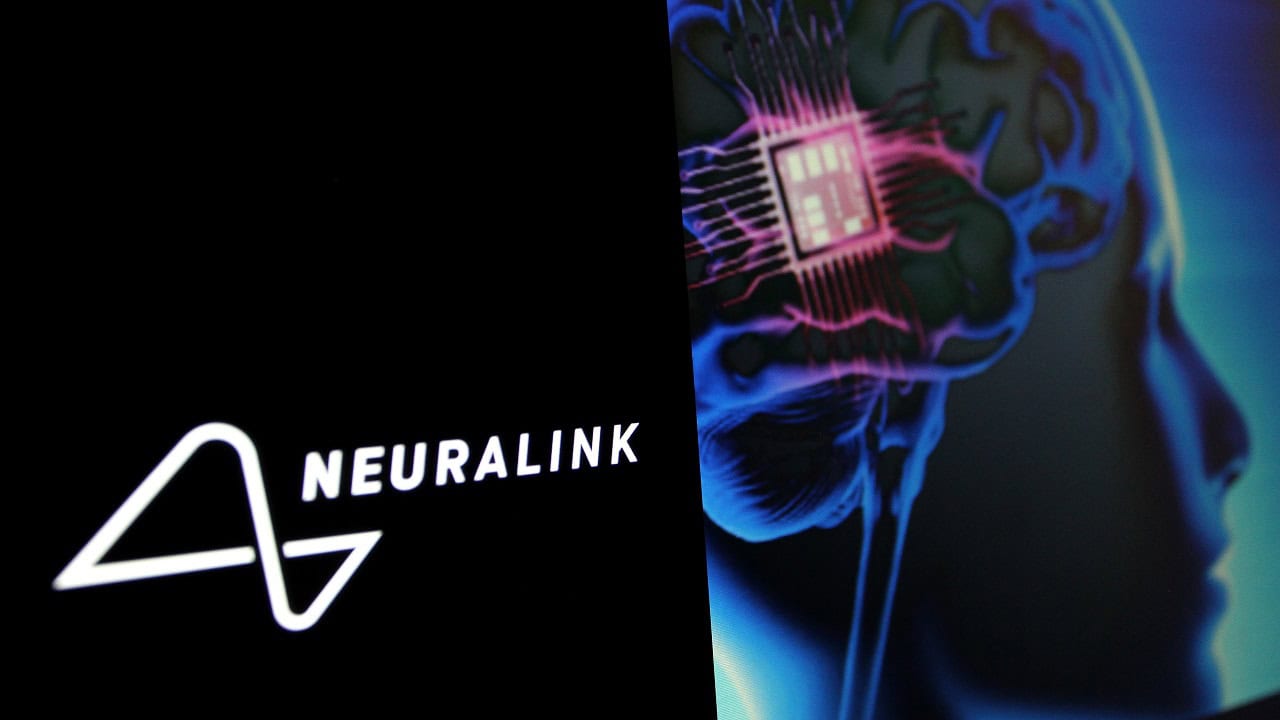 Proyek Gila Abad Ini: Chip Otak Neuralink Ubah Masa Depan Umat Manusia?