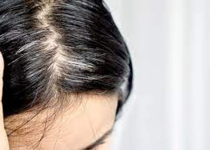 5 Cara Alami Mengatasi Uban di Rambut  yang Mulai Tumbuh di Bagian Kepala Anda 