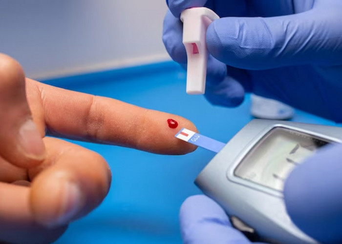 Catat! Inilah Cara Untuk Mencegah Lonjakan Gula Darah Setelah Makan ala dr Zaidul Akbar