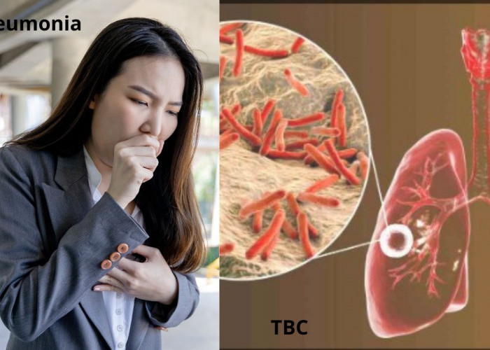 Lebih Berbahaya Mana, Pneumonia atau TBC ?