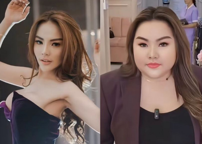 Lisa Mariana Tolak Permintaan USG dari Ridwan Kamil: Khawatir Hasil Direkayasa
