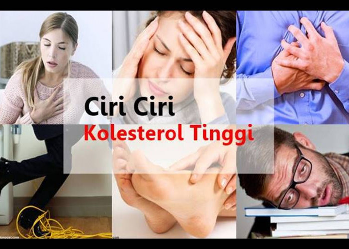 Jangan Sampai Lalai! Cek Ciri-Ciri Kolesterol dan Pentingnya Mengetahuinya sejak Dini