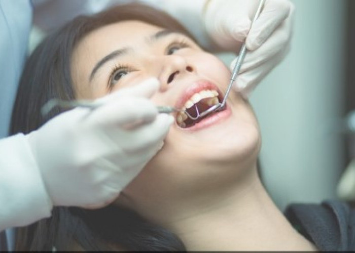 Tips Hilangkan Karang Gigi Secara Alami, Penanganan Dini Bisa Dilakukan di Rumah