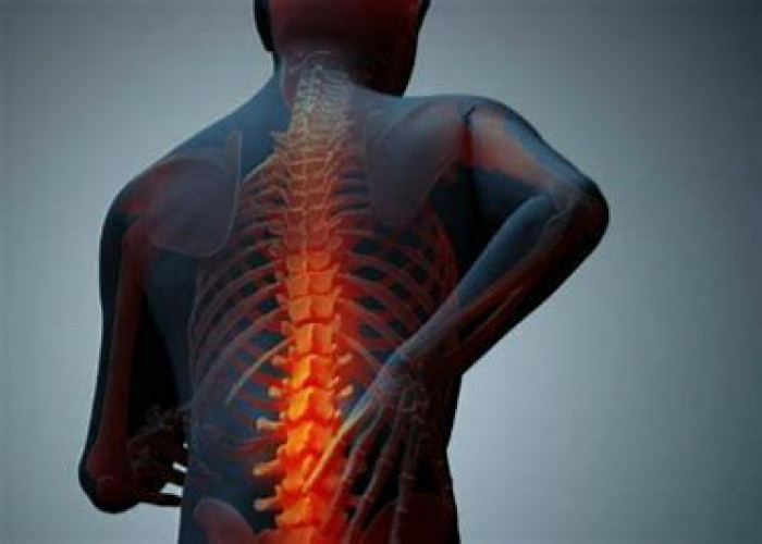5 Penyebab Muculnya Penyakit Osteoporosis Pada Usia Muda: Nomor 3 Paling Berat?