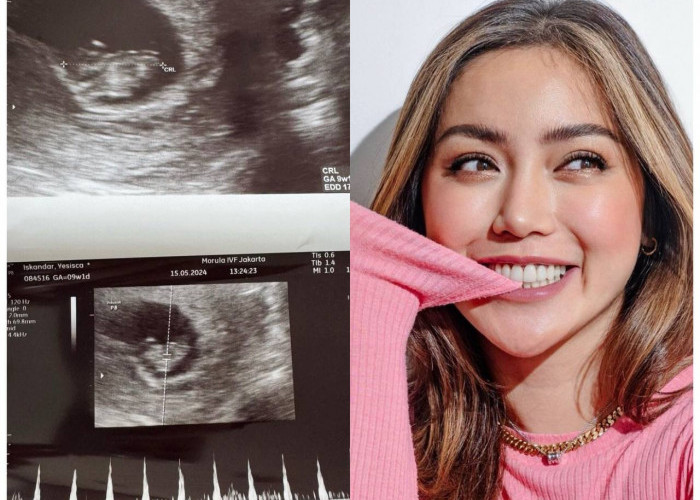 Hamil Anak Ketiga Lewat Program Bayi Tabung, Jessica Iskandar dan Vincent Ingin Punya Anak Bershio Naga
