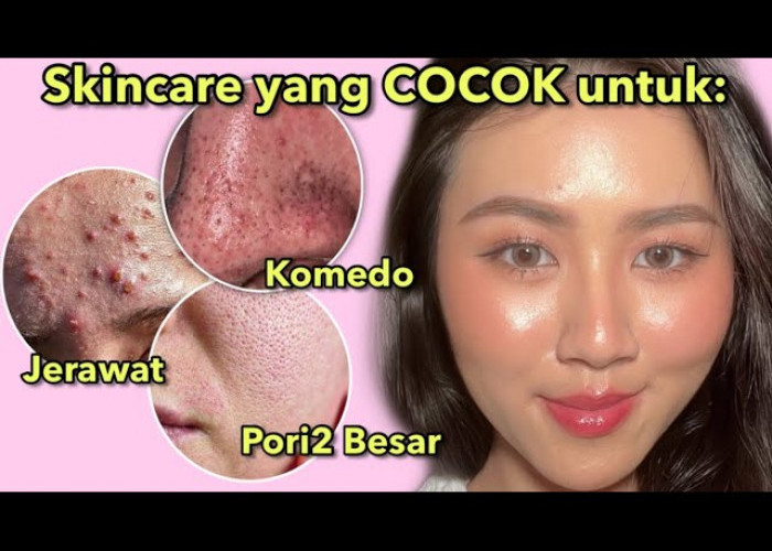 Rekomendasi 4 Produk Skincare Lokal dan Halal Untuk Kulit Berminyak dan Berjerawat di Indomart