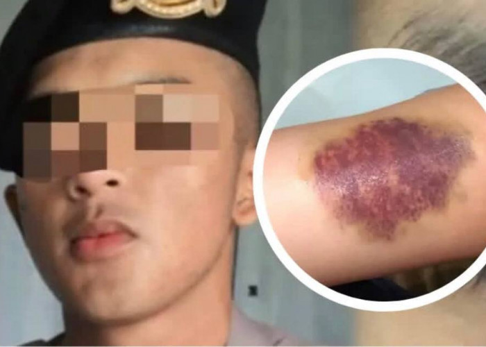 Viral, Seorang Oknum Polda Jabar Aniaya Kekasih hingga Lebam dan Trauma, Gegara Kepergok Notif DM Instagram 